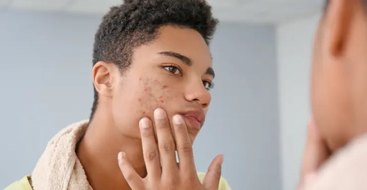 man asking himself in the mirror does vegan protein powder cause acne